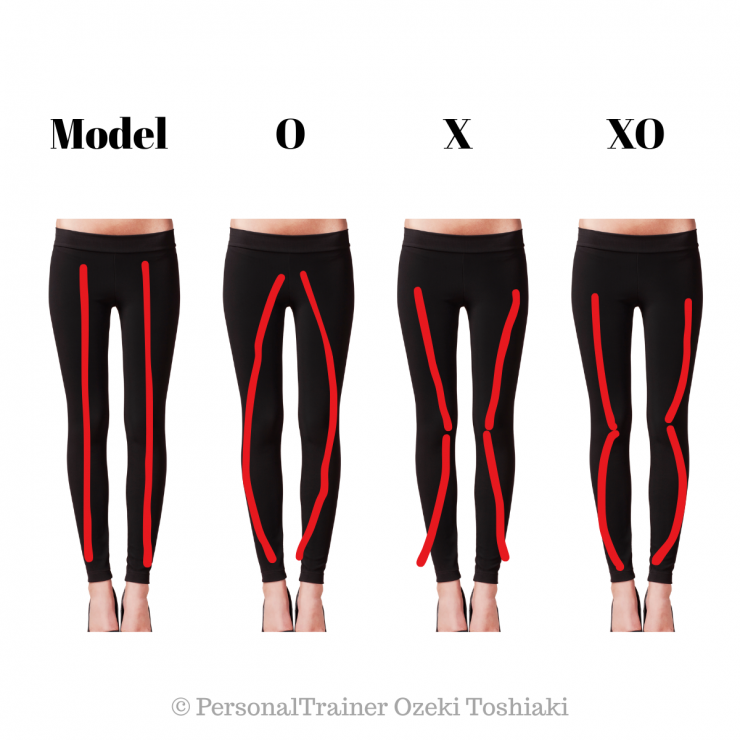 Model脚・O脚・X脚・XO脚
